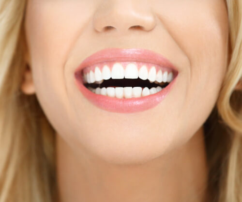 Tooth Contouring (Enameloplasty)